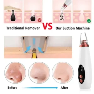 Electric Face Suction Removal Machine Pore Cleaner, blackhead , Whitehead , Soft Pimple , Oil Remover machine ( 5 Suction)