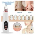 Electric Face Suction Removal Machine Pore Cleaner, blackhead , Whitehead , Soft Pimple , Oil Remover machine ( 5 Suction) - Image 7
